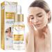 Huile essentielle pour les yeux pour liminer les taches Milia estomper les cernes dissoudre et r duire le milia - Essence de granul s de graisse - limine les taches sombres de la peau - Am liore