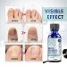 Extra Strength Toenail Fungus Treatment - Fast Acting Home Solution for Healthy Nails | Repair & Renew Damaged Toenails in One Week - Buy Online on GoSupps.com