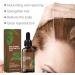 Batana Oil for Hair Growth Natural Batana Oil from Honduras Repair Damaged Hair Prevents Hair Loss Increases Shine Batana Oil for Healthier Thicker Fuller Hair 30ML - Buy Online on GoSupps.com