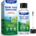 SCOBUTY Skin Tag Removal Kit Verruca Treatment Wart and Mole Remover for Hands Face