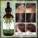 Rosemary Essential Oil for Hair Growth-60ML Rosemary Oil 100% Pure Hair Care Essential Oil Strengthens Hair Roots and Nourishes the Scalp for Women&Men - Buy Online on GoSupps.com