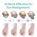 Ashomie Gel Toe Spacer Separator 2 Pack - Bunion Corrector & Pain Relief with Adjustable Soft Toe Spacers - Fits Shoe Sizes 5-11 - Buy Online on GoSupps.com