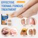 Roser 32 Piece Toenail Correction Patch | Nail Repair & Strengthening for Damaged & Discolored Nails - Buy Online on GoSupps.com