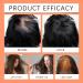 Natural Batana Oil for Healthy Hair Hair Butter with 100% Pure Raw Batana Oil Enhances Hair & Skin Radiance Hair Growth Butter for All Hair Types Promotes Hair Strength 4.23 oz - Buy Online on GoSupps.com