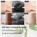 Nosestripes Blackheads Blackhead Nose Strips Deep Cleansing Clear-Up Strips 30 Pieces Nose Strips Pore Strips Anti Nose Stripes Blackheads Remove Blackheads and Impurities - Buy Online on GoSupps.com