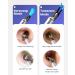 BEBIRD Ear Wax Removal Kit with HD Otoscope & LED Light - 3 in 1 Earwax Remover for Adults & Kids (Blue) - Buy Online on GoSupps.com