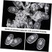 Healeeved 300 Pairs Transparent Glasses Nose Pads - Cushion for Comfort & Protection | Clear Replacement Nasal Pads 2x3stk 1.4x0.8cm 3PCs - International Shipping Available - Buy Online on GoSupps.com