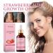 Strawberry Mint Hair Oil | Organic Growth Serum for Thin & Damaged Hair (2PCS) - Buy Internationally - Buy Online on GoSupps.com