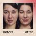 Retinol Serum for Face & Neck 2.5% - Face Serum w/Hyaluronic Acid Aloe Vera & Vitamin B3 Resurfacing Retinol Serum Moisturizing & Brightening Retinoid Serum for Women & Men - Buy Online on GoSupps.com