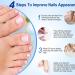 Fungal Nail Treatment - Nail Fungus Treatment for Toenail - Toe Nail Treatment Extra Strong - Nail Repair Treatment for Restores Damaged Nails - 8 Hours Nail Repair Restores Healthy Nails(32 Patches) - Buy Online on GoSupps.com