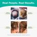 Shapiro MD DHT Fighting Hair Loss Shampoo | Vegan Formula for Thinning Hair | Dermatologist Developed for Healthier, Fuller, Thicker Hair | 2-Month Supply 16 Fl Oz - Buy Online on GoSupps.com