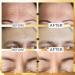 Jakuva 24K Gold Forehead Wrinkle Patches | Hydrogel Pads with Collagen & Vitamin E - Moisturizing Forehead Care (20PCS - Buy Online on GoSupps.com