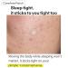 TIAM Surprise B Hydrocolloid Acne Pimple Patch - 96 Count (Pack of 4) | Fast Shipping Worldwide - Buy Online on GoSupps.com