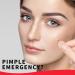 Original Hydrocolloid Acne Pimple Patch - Invisible Spot Stickers for Face & Skin Perfect for Teens - Blemish Coverage & International Shipping - Buy Online on GoSupps.com