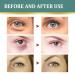 Jasmine Ointment Eye Cream | Reduces Dark Circles Wrinkles & Puffiness | Collagen & Aloe Vera | 3PC Set - Buy Online on GoSupps.com