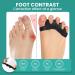 Welnove Toe Separators Bunion Corrector - 8 Pcs Gel Straighteners for Hammertoes | Buy Now for Pain Relief & Correct Foot Alignment - Buy Online on GoSupps.com
