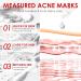 Gel Localis Anti-Imperfections Peaux Mixtes Grasses Action Anti-Imperfections Formule Douce Texture L g re - Buy Online on GoSupps.com
