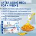 Heca Natural Herbal Hemorrhoid Relief Capsules - Fast Acting Treatment for Itching, Burning, Pain & Discomfort - 7Pcs/Box, 3 Boxes - Buy Online on GoSupps.com