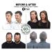 Kmax Hair Fibers - Keratin Hair Loss Coverage Pocket Size (5 Bottles x 3g) - Light Gray | International Shipping - Buy Online on GoSupps.com