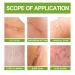 Goopgen Advanced Scar Repair Serum - Intensive Scar Treatment (1PC) - Buy Online on GoSupps.com