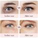 Rose Hyaluronic Acid Eye Cream Anti Aging Under Eye Cream for Dark Circles and Eye Bags Fade Fine Lines Firming and Moisturizing Eye Repair Cream Korean Eye Cream Skincare for All Skin Types- 20g - Buy Online on GoSupps.com