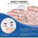 Pcomrich Anti-Snoring Magnetic Nose Clip - Stop Snoring Sleep Aid (4 Clips) - Buy Online on GoSupps.com