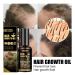 Hair Growth Serum | Accelerate Thicker Fuller Hair - Fast-Acting Formula for All Hair Types - Buy Online on GoSupps.com