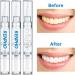 RENPHO Teeth Whitening Pens 3 Pack - Professional 35% Carbamide Peroxide Gel for Sensitive Teeth - No Sensitivity, Painless, Easy to Use - 20+ Uses - Buy Online on GoSupps.com