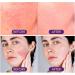 Soothing & Barrier Support Serum Face Serum for Women Face Moisturiser Hydrating&Brightening Serum Skincare Serum Relieves Dry/Tight/Reddened Skin Anti Aging Serum for Face Dark Spot Remover for Face - Buy Online on GoSupps.com
