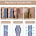 Women's 20-30 mmHg Compression Pantyhose 2 Pairs - Support Stockings for Varicose Veins - Large Size, Closed Toe - Buy Online on GoSupps.com