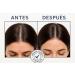 Shampoing Anti-Chute 1000 ml Professionnel Cheveux Fins Fortifiant Cuir Chevelu Densit & Vitalit Chute Saisonni re/Androg n tique - Buy Online on GoSupps.com
