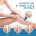 Soothing Leg Balm 100g Lightly Absorbed Repairing and Moisturizing Vein Cream - for Men Women and Adults - Vein Discomfort Prolonged Standing Daily Care - Buy Online on GoSupps.com