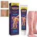 Varicose Veins Cream Spider Veins Repair Cream Varicose Veins Treatment Cream Varicose Veins Relief Cream Cream for Varicose Veins in Legs Varicose Veins Treatment for Legs Varicose Veins Ointment