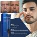 AKARY Awaken Peptide Depuffing Eye Gel | OPENEYES Lifts Firming Eye Tightener | Men's Moisturizing Eye Cream | Hydrating Eye Gel for Dark Circles, Puffiness, Fine Lines, and Bags - 0.50 oz - Buy Online on GoSupps.com