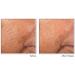 RoC - Retinol Correxion Smoothing Night Serum - Anti-Wrinkle and Aging - Anti-Aging - Firming Moisturizer - 30 Capsules - Buy Online on GoSupps.com