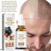 Xltyyds Puraect Fermented Rice Water Serum - Biotin Hair Growth Enhancer for Thinning Hair & Hair Loss (10ml 2PCs) - International Shipping Available - Buy Online on GoSupps.com