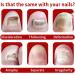 Quick Relief Oil Fungal Nail Treatment Rapid Relief Oil Nail Fungus Treatment For Toenail Nail Treatment Oil Toe Nail Fungal Treatment Onychomycosis Nail Treatment Toenail Repair for Damaged Nails - Buy Online on GoSupps.com