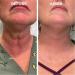 Skin Firming Rejuvenating Moisturising Essence with Hyaluronic Acid Firming Cream for Face and Neck Moisturising Firming Face Firming - Buy Online on GoSupps.com