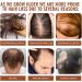 Batana Oil for Healthy Hair Batana Oil for Hair Growth Nourishes Thin Hair Scalp Skin and Loss Hair Growth Natural Batana Oil Promotes Hair Wellness for Men & Women Hair Care Hair Treatment(50ml) - Buy Online on GoSupps.com
