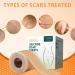 Silicone Scar Sheets | Scar Patches for C-Section Acne & Keloid Treatment - 1.6 x120  - Buy Online on GoSupps.com
