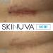 Skinuva Complete Care System - Hyperpigmentation & Scar Treatment with Bruise Relief - 1 oz Cream, 0.5 oz Next Gen Scar Cream, 14 Capsules - Buy Online on GoSupps.com