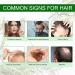 Rosemary Oil for Hair Growth - 100% Pure Natural Essential Oil (2 Pack) | Nourishes Scalp & Stimulates Hair Growth for All Hair Types | 60ml Each - Buy Online on GoSupps.com