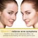 Shop Vitamin C Cream - Anti-Aging Face Moisturizer with Hyaluronic Acid & Niacinamide for Wrinkle Reduction | International Shipping - Buy Online on GoSupps.com