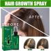 Eayoly Hair Growth Serum - 120ml Hair Lotion Hair Growth Serum Nourishing Nutrient Hair Lotion for Strong And Dense Hair Anti Hair Loss Promotes Hair Root - Buy Online on GoSupps.com