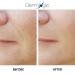 Anti-Aging Resurfacing Peel Pads with Salicylic, Glycolic, and Lactic Acid - Hyaluronic, Witch Hazel, Green Tea, and Aloe Vera - Exfoliates for Dark Spots & Scars - Buy Online on GoSupps.com