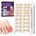 Ingrown Toenail Corrector, Ingrown Toenail Treatment, Glue-Free Toenail Corrector Patch, 50 Pcs - Pedicure Tools