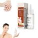 GFOUK 7 Days Nail Growth And Strengthening Serum Nail Growth And Strength Serum Nail Serum Repair Essence Nail Cuticle Oil Strengthener Stronger Nails In 1 Week Nail Strengthening Treatment (1PC) 1pcs