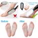 Sularpek Foot File Foot Scraper Best Foot Care Pedicure Metal Surface Tool to Remove Hard Skin Can Be Used on Both Wet and Dry Feet Surgical Grade Stainless Steel File - Buy Online on GoSupps.com