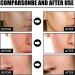 50ml Facial Nicotinamide Serum Nicotinamide Hydrating Serum Spots Removal Minimizing Pores Nicotinamide Brightening - Buy Online on GoSupps.com