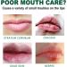 Mouth Ulcer Treatment Spray Mouth Ulcer Treatment for Adults Canker Sore Treatment Oral Care Spray Herbal Mouth Spray Canker Sores Relief Spray for Mouth Ulcer Bad Breath Treatment Mouth Freshener - Buy Online on GoSupps.com